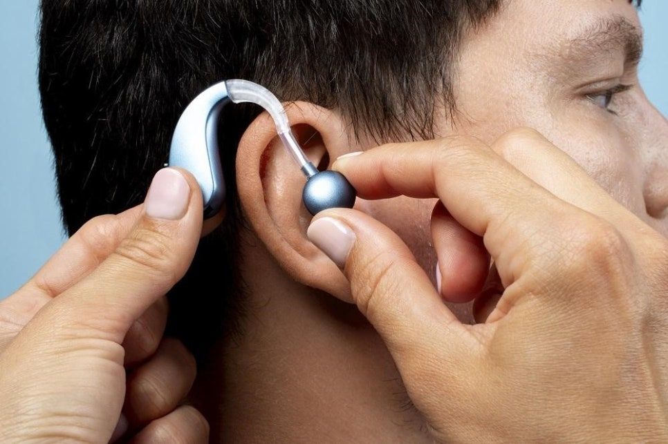 Cochlear Implants Market: Technology Advancements and Future Projections